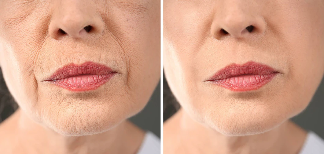 Breakthrough Skin Treatment